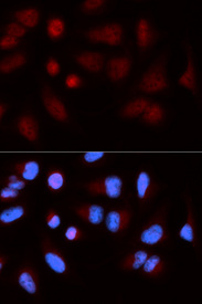 Immunofluorescence analysis of U20S cell using SH2B1 antibody. Blue: DAPI for nuclear staining.