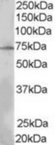 Antibody (0.3 ug/ml) staining of MOLT4 lysate (35 ug protein in RIPA buffer). Primary incubation was 1 hour. Detected by chemiluminescence.
