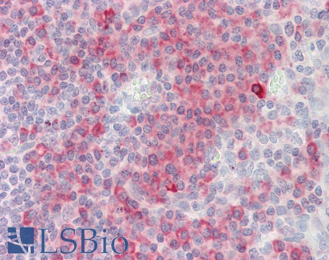 Anti-SH2D1A / SAP antibody IHC staining of human tonsil. Immunohistochemistry of formalin-fixed, paraffin-embedded tissue after heat-induced antigen retrieval. Antibody LS-B10338 concentration 10 ug/ml.
