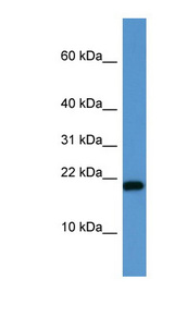SH2D1A / SAP antibody Western blot of Jurkat lysate.