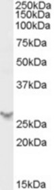 Antibody (0.5 ug/ml) staining of Human Spleen lysate (35 ug protein in RIPA buffer). Primary incubation was 1 hour. Detected by chemiluminescence.