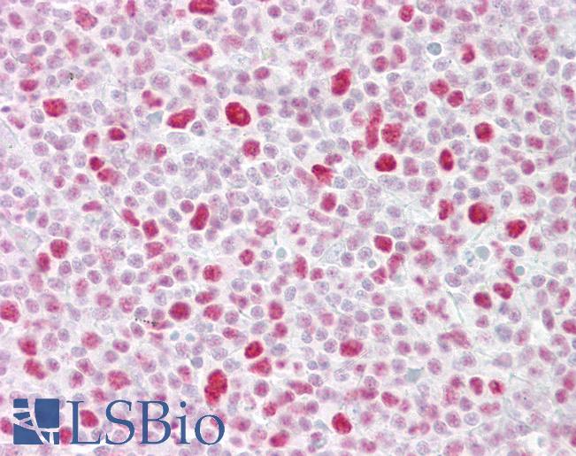 Anti-PSME3 antibody IHC of human tonsil. Immunohistochemistry of formalin-fixed, paraffin-embedded tissue after heat-induced antigen retrieval. Antibody LS-B6840 concentration 5 ug/ml.