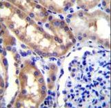 SH2D4A Antibody immunohistochemistry of formalin-fixed and paraffin-embedded human kidney tissue followed by peroxidase-conjugated secondary antibody and DAB staining.