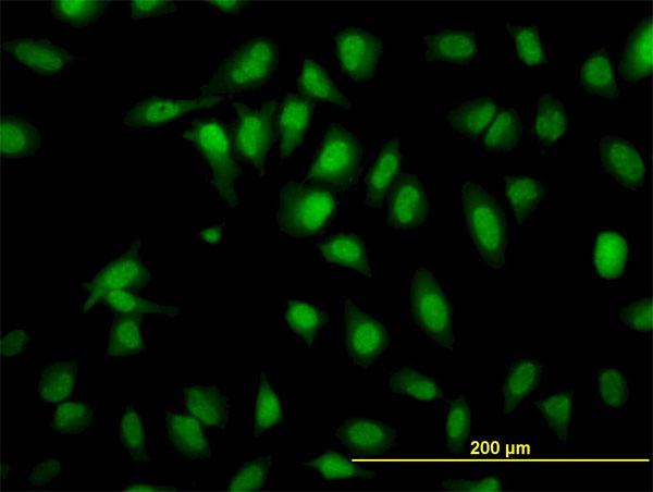 Immunofluorescence of monoclonal antibody to SH2D4A on HeLa cell. [antibody concentration 30 ug/ml]
