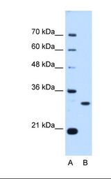 Lane A: Marker. Lane B: HepG2 cell lysate. Antibody concentration: 0.25 ug/ml. Gel concentration: 12%.