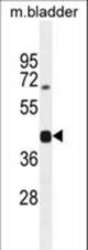 SH2D5 Antibody western blot of mouse bladder tissue lysates (35 ug/lane). The SH2D5 antibody detected the SH2D5 protein (arrow).