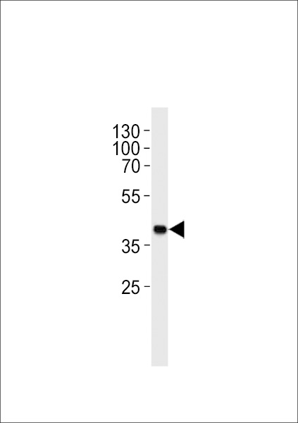 Mouse Sh2d5 Antibody western blot of mouse heart tissue lysates (35 ug/lane). The mouse Sh2d5 antibody detected the mouse Sh2d5 protein (arrow).