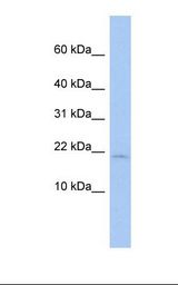 MCF7 cell lysate. Antibody concentration: 1.0 ug/ml. Gel concentration: 10-20%.