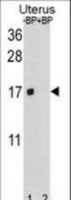 Western blot of SH3BGRL Antibody antibody pre-incubated without(lane 1) and with(lane 2) blocking peptide in human Uterus tissue lysate. SH3BGRL Antibody (arrow) was detected using the purified antibody.