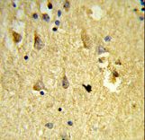 Formalin-fixed and paraffin-embedded human brain tissue reacted with SH3BGRL3 Antibody , which was peroxidase-conjugated to the secondary antibody, followed by DAB staining. This data demonstrates the use of this antibody for immunohistochemistry; clinical relevance has not been evaluated.
