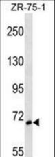 SH3BP1 Antibody western blot of ZR-75-1 cell line lysates (35 ug/lane). The SH3BP1 antibody detected the SH3BP1 protein (arrow).
