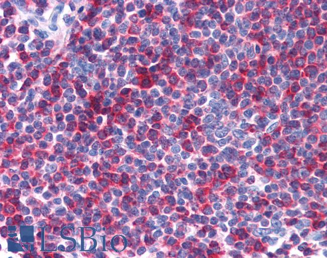 Anti-SH3BP1 antibody IHC of human tonsil. Immunohistochemistry of formalin-fixed, paraffin-embedded tissue after heat-induced antigen retrieval. Antibody LS-B3930 concentration 2.5 ug/ml.