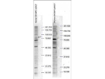 Anti-SH3BP2 pS427 Antibody - Western Blot. Western blot analysis is shown using Affinity Purified anti-SH3BP2 pS427 antibody to detect endogenous protein present in unstimulated human whole cell lysates). The band as indicated by the arrowheads is evident in both M059 cells (panel A) and PC-3 cells (panel B). Comparison to a molecular weight marker indicates a band of ~60 kD corresponding to human SH3BP2 protein. The blot was incubated with a 1:500 dilution of the antibody at room temperature followed by detection using standard techniques. Personal communication Steven Pelech, Kinexus Inc.
