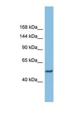 Western blot of Human THP-1. SH3BP4 antibody dilution 1.0 ug/ml.