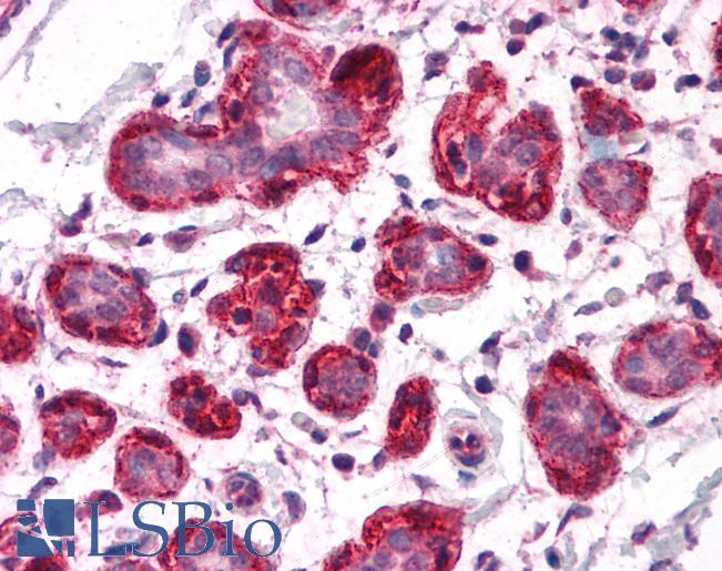 Anti-SH3BP4 antibody IHC of human breast. Immunohistochemistry of formalin-fixed, paraffin-embedded tissue after heat-induced antigen retrieval. Antibody LS-B4604 concentration 5 ug/ml.