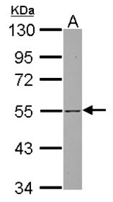 Sample (30 ug of whole cell lysate) A: Jurkat 10% SDS PAGE SH3BP5 antibody diluted at 1:1000