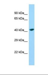 Western blot of Jurkat. SHROOM1 antibody dilution 1.0 ug/ml.