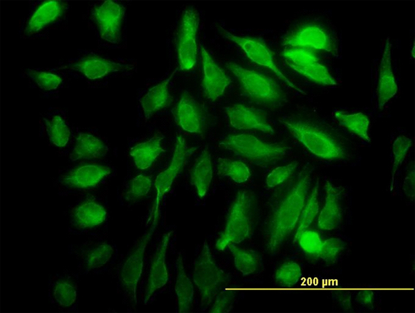Immunofluorescence of monoclonal antibody to SH3D19 on HeLa cell (antibody concentration 10 ug/ml).