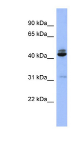 SH3GL1 / Endophilin-A2 antibody LS-C107535 Western blot of Jurkat lysate.