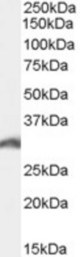Antibody (0.1 ug/ml) staining of K562 cell lysate (35 ug protein in RIPA buffer). Primary incubation was 1 hour. Detected by chemiluminescence.
