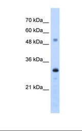 HepG2 cell lysate. Antibody concentration: 1.25 ug/ml. Gel concentration: 12%.