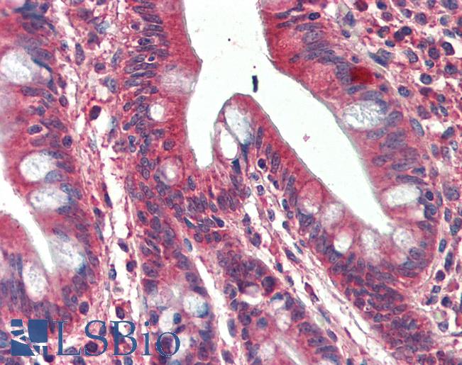 Human, Small intestine: Formalin-Fixed Paraffin-Embedded (FFPE)