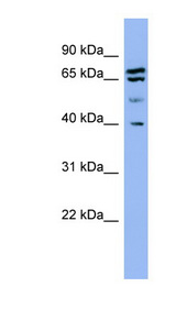 SH3GL2 antibody LS-C107579 Western blot of HeLa lysate.
