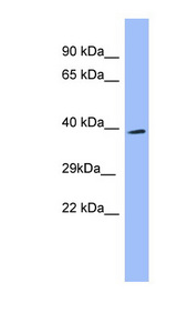 SH3GL2 antibody LS-C107578 Western blot of Placenta lysate.