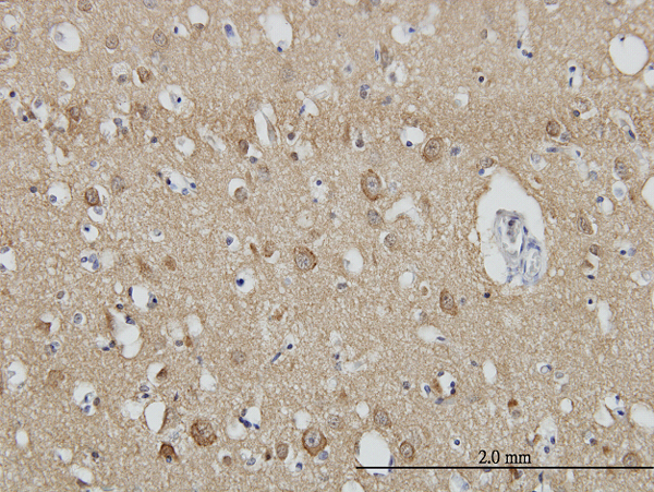 Immunoperoxidase of monoclonal antibody to SH3GL2 on formalin-fixed paraffin-embedded human cerebral cortex. [antibody concentration 3 ug/ml]