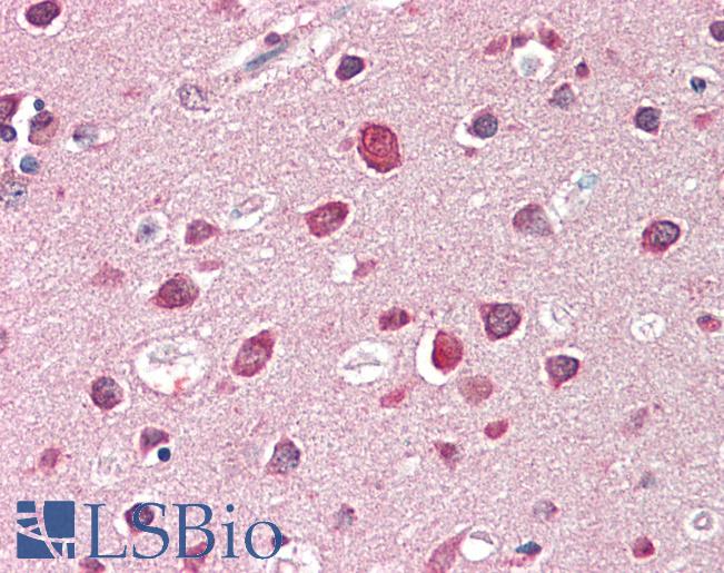 Anti-SH3GL2 antibody IHC staining of human brain, cortex. Immunohistochemistry of formalin-fixed, paraffin-embedded tissue after heat-induced antigen retrieval. Antibody LS-B10349 concentration 5 ug/ml.