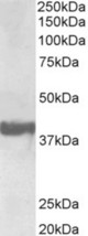 SH3 ugL2 antibody (0.3 ug/ml) staining of Human Frontal Cortex lysate (35 ug protein in RIPA buffer). Primary incubation was 1 hour. Detected by chemiluminescence.