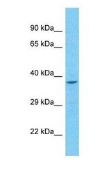Western blot of SH3GL3 Antibody with Jurkat Whole Cell lysate.