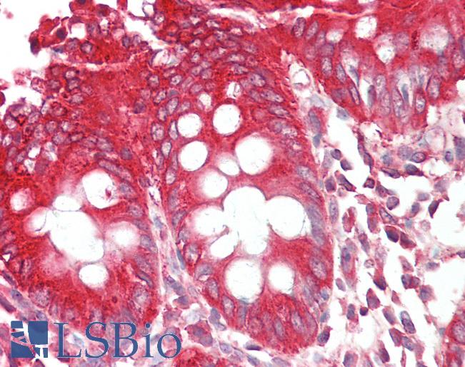 Anti-SH3GLB1 / Bif / Endophilin B1 antibody IHC staining of human colon. Immunohistochemistry of formalin-fixed, paraffin-embedded tissue after heat-induced antigen retrieval. Antibody LS-B11165 concentration 2.5 ug/ml.