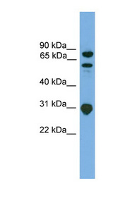 SH3KBP1 antibody LS-C116580 Western blot of Jurkat lysate.