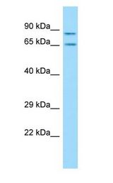 SH3KBP1 / CIN85 antibody Western Blot of Rat Thymus.