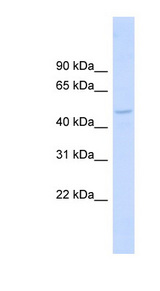 DBNL / HIP-55 antibody LS-C111559 Western blot of Fetal Muscle lysate.