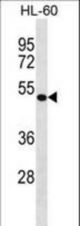 DBNL Antibody western blot of HL-60 cell line lysates (35 ug/lane). The DBNL antibody detected the DBNL protein (arrow).