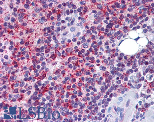 Anti-SH3RF2 antibody IHC of human spleen. Immunohistochemistry of formalin-fixed, paraffin-embedded tissue after heat-induced antigen retrieval. Antibody LS-B5323 concentration 5 ug/ml.