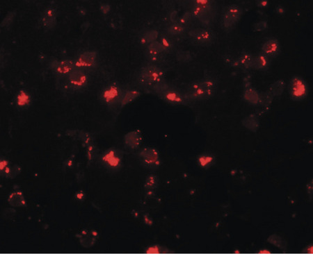 Immunofluorescence of SH3RF2 in human brain tissue with SH3RF2 antibody at 20 ug/ml.