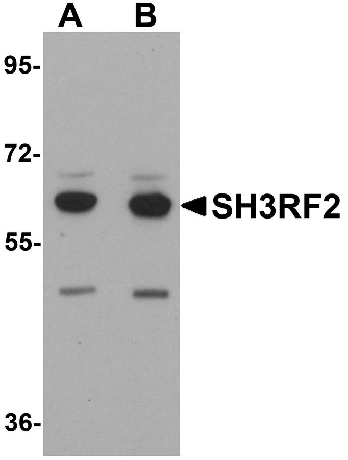 Western blot analysis of SH3RF2 in 3T3 cell lysate with SH3RF2 antibody at (A) 1 and (B) 2 ug/ml.