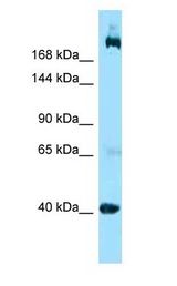 SHANK2 / SHANK antibody Western Blot of Jurkat.