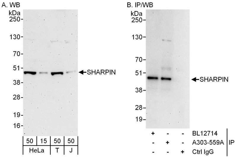 Detection of Human SHARPIN by Western Blot and Immunoprecipitation. Samples: Whole cell lysate from HeLa (15 and 50 ug for WB; 1 mg for IP, 20% of IP loaded), 293T (T; 50 ug) and Jurkat (J; 50 ug) cells. Antibodies: Affinity purified rabbit anti-SHARPIN antibody used for WB at 0.1 ug/ml (A) and 1 ug/ml (B) and used for IP at 6 ug/mg lysate. SHARPIN was also immunoprecipitated by rabbit anti-SHARPIN antibody BL12714, which recognizes an upstream epitope. Detection: Chemiluminescence with exposure times of 3 minutes (A) and 30 seconds (B).