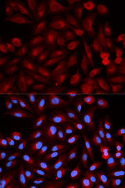 Immunofluorescence analysis of HeLa cell using PSME3 antibody. Blue: DAPI for nuclear staining.