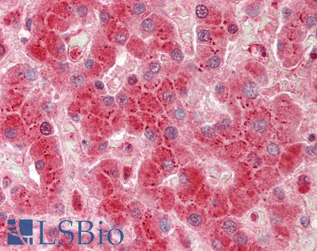 Human Liver: Formalin-Fixed, Paraffin-Embedded (FFPE)