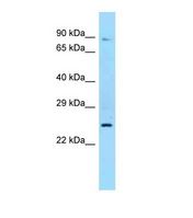 Western blot of Human MCF7. SHBG antibody dilution 1.0 ug/ml.