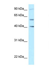 SHCBP1L antibody LS-C145929 Western blot of Jurkat Cell lysate. Antibody concentration 1 ug/ml.