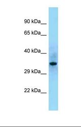 Western blot of Human 293T . SHF antibody dilution 1.0 ug/ml.