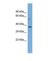Western blot of Human THP-1. FBXW4 antibody dilution 1.0 ug/ml.