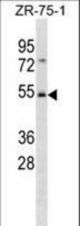 FBXW4 Antibody western blot of ZR-75-1 cell line lysates (35 ug/lane). The FBXW4 antibody detected the FBXW4 protein (arrow).