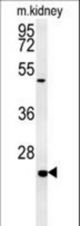SHISA2 Antibody western blot of mouse kidney tissue lysates (15 ug/lane). The SHISA2 antibody detected SHISA2 protein (arrow).
